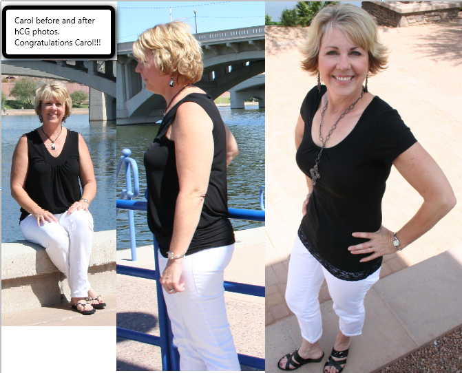 hcg drops diet before and after photos. Before and After hCG – Carol